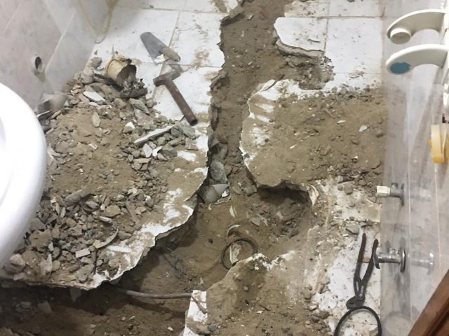 önce sonra vaka görselleri 3