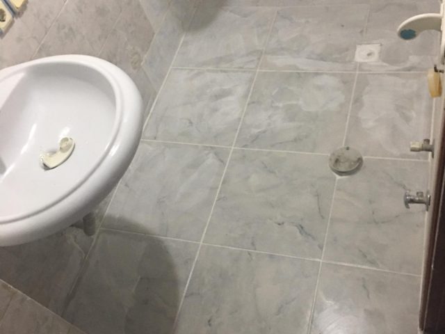 önce sonra vaka görselleri 4