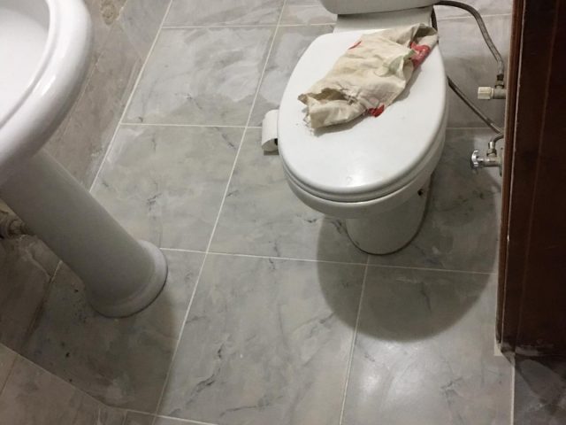 önce sonra vaka görselleri 6